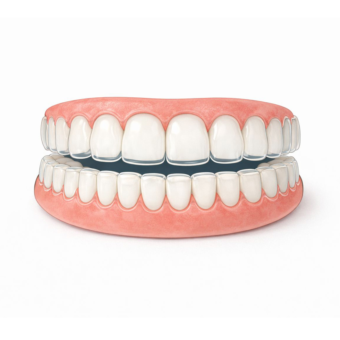 Transparente Aligner Zahnschienen