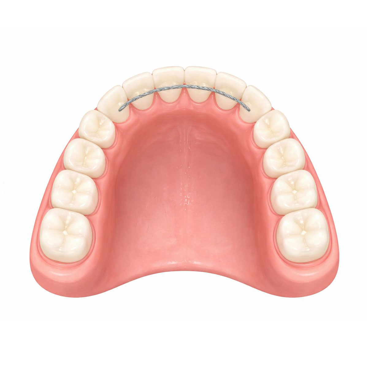 KFO Retainer Nachsorge